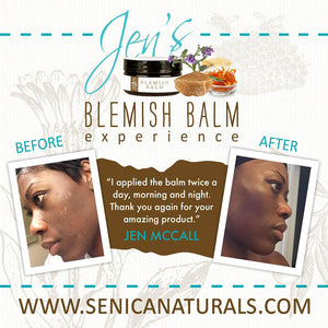 Blemish Balm moisturizer for dry skin and eczema